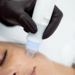 cure-facial-aquafacial-246746